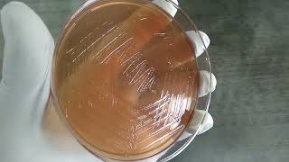 Vibrio cholerae colony morphology on Macconkey agar Demonstration [upl. by Ikkiv]