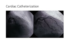 Cardiac Catheterization [upl. by Dareece]