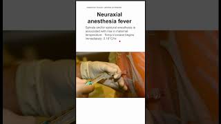 Neuraxial anesthesia fever [upl. by O'Brien]