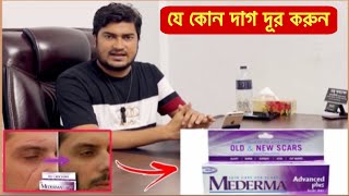 Mederma Advanced Scar Removal Gel  অপারেশন এর দাগ দ্রুতগতিতে দূর করে যে ক্রিম  Scar Removal Cream [upl. by Naloj]