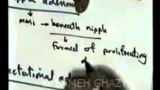 GENITAL 6 fibrocystic disease amp breast cancer DR SAMEH GHAZY [upl. by Adnoyek48]