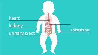 Conditions Explained Esophageal Atresia [upl. by Aicak]