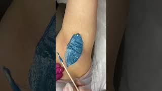 Underarm depilation with wax [upl. by Louanna]