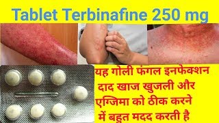 Tablet Terbinafine 250 Mg Full Review In Hindi  Uses  Dose  Side Effects Tarbinafine Tablet Uses [upl. by Esteban]