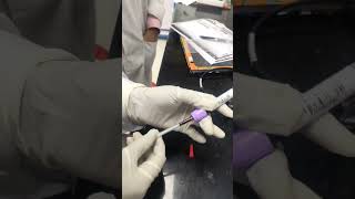 Trop T test youtube ytshort pathology lab dmlt medical bloodtest shorts Tropt [upl. by Noslien928]