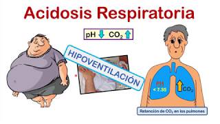 INTERPRETACIÓN DE LA GASOMETRÍA EN 4 PASOS 💉💉 con EJERCICIOS de PRÁCTICA al final del video [upl. by Nanreik]