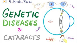 Genetic Diseases 🧬 and Cataracts 👁 [upl. by Atsillak]