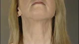 Faceworks Natural Facelift Chin amp Jaw Toner  lose your double chin and tone loose skin [upl. by Meghann490]