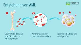 AML einfach erklärt ❕ Was ist Akute Myeloische Leukämie Experte erklärt [upl. by Adella]