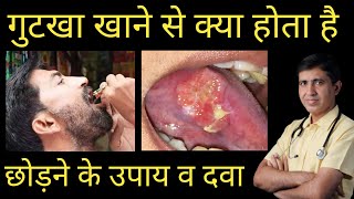 गुटखा खाने से क्या होता है  नुकसान  गुटखा छोड़ने के उपाय  Gutkha Chodne ki Dawai  Homeopathic [upl. by Nilek]