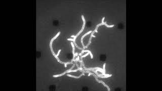 A mechanism for FtsZindependent proliferation in Streptomyces [upl. by Millburn518]