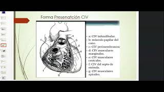 CARDIOPATIAS CONGENITAS ACIANOTICAS [upl. by Lepp]