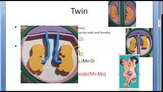 Obstetrics 255 d Fetal Baby complications Multiple Pregnancy Twin TTTS TRAP Delivery Baby Manage [upl. by Esinert451]