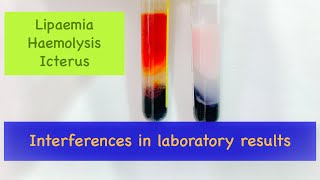 How lipaemia haemolysis and icterus interferes with laboratory results [upl. by Attikram]