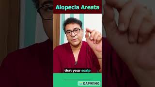 Unlocking Alopecia Areata Dr Vikram’s Expert Secrets  Neograft Chandigarh alopeciaareata [upl. by Klug542]