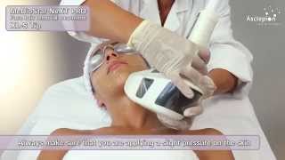 MeDioStar NeXT PRO XL  Training video for hair removal with BASIC mode from Asclepion [upl. by Fan]