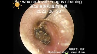 Ear wax removalFungus cleaning 耳垢清除和真菌清理20230820 [upl. by Sender]