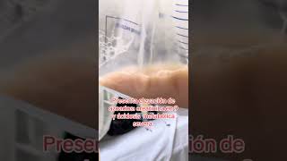 PIURIA  SEPSIS FOCO URINARIO [upl. by Anirec]