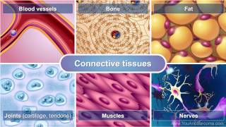 Understanding Soft Tissue Sarcoma [upl. by Ardet]