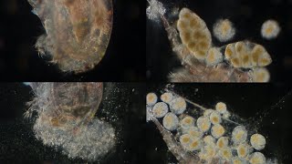 Copepod Corpse Spills Its Guts As Its Eggs Burst  100x [upl. by Nuawd368]