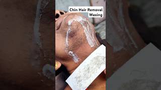 Chin Hair Waxing  Chin Hair Removal hairremoval chinwaxing [upl. by Henryk]