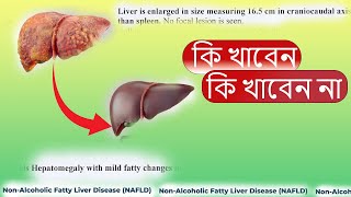 Non Alcoholic Fatty Liver Foods to be Eat amp Avoid [upl. by Power]