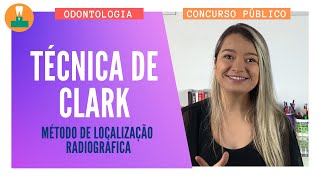 Técnica de Clark  Método de Localização Radiográfica Concurso Público [upl. by Natfa132]