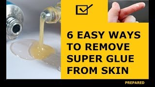 How to Remove Super Glue from Skin  6 Ways to Remove Super Glue from Skin [upl. by Adnalra]