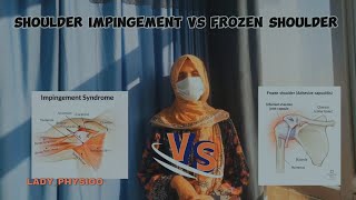 Frozen shoulder vs shoulder impingement Key differences causes symptoms and treatment [upl. by Wat]