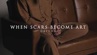 When Scars Become Art Acoustic  Gatton [upl. by Nonez]