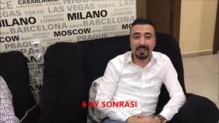 Saç ekimi öncesi 3 ay ve 6 ay sonrası aşamalar örnekler Haartransplantation hair transplantation [upl. by Neve]