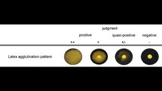 Latex Agglutination Test  Amrita University [upl. by Yila488]