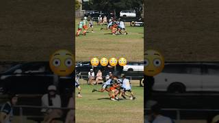 Rugby League’s Most Horrific Accidental Injuries [upl. by Amapuna]