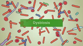 Fecal microbiotabased treatments for C diff infection [upl. by Cloris]