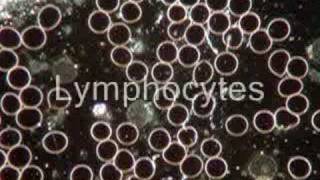 White Blood Cells Live Blood Analysis [upl. by Ragse]