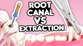 Root Canal vs Tooth Extraction What’s the Right Choice [upl. by Anitap261]