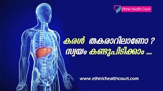 Alcoholics  Tips to Find Out Liver Damage  Liver Disease Symptoms Malayalam  Ethnic Health Court [upl. by Aimat]