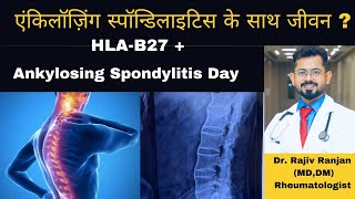 एंकिलॉज़िंग स्पॉन्डिलाइटिस के साथ कैसे जिये  । Life with Ankylosing Spondylitis [upl. by Adnama]