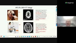 CT Spectral imaging Vs Conventional CT [upl. by Vastah]