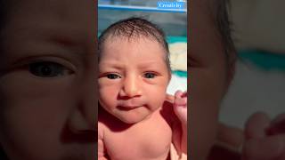 See The Eye🥰medical cutebaby [upl. by Gasper]