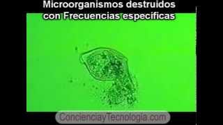 Microorganismos Destruidos por frecuencias especificas [upl. by Merp]