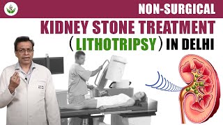 Non Surgical Kidney Stone Treatment Lithotripsy in Delhi  Care Well Medical Centre [upl. by Allyce]