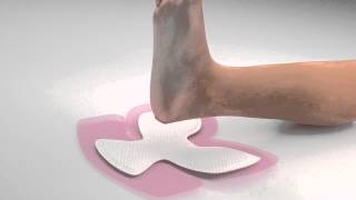 Remove ALLEVYN Life Heel Dressing from the Heel [upl. by Araihc]