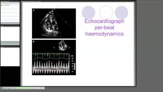 Part 4 Hemodynamic Monitoring [upl. by Ohare]