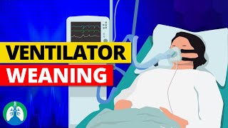 Weaning from Mechanical Ventilation  Criteria and Parameters [upl. by Labina770]