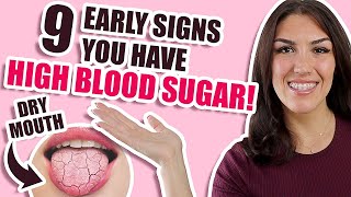 Hyperglycemia Symptoms Early Signs of HIGH BLOOD SUGAR Insulin Resistance or Diabetes [upl. by Sanez926]