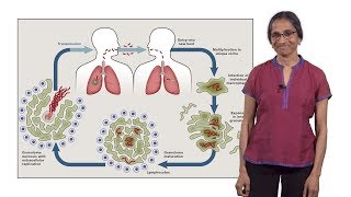 Lalita Ramakrishnan Cambridge 1 Tuberculosis The Pathogenic Personality of the Tubercle bacillus [upl. by Tavia]