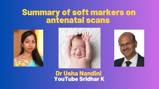 Summary of soft markers on antenatal scans screening pregnancy trisomy softmarkers [upl. by Stodder]