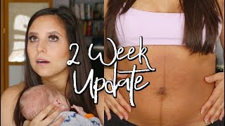 2 WEEK POSTPARTUM UPDATE  4th Degree Tear  Episiotomy Recovery [upl. by Most]