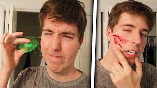 Fidget Spinner Vs Face Legit Had To Get Stitches [upl. by Eijneb]